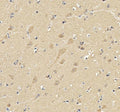 IHC staining of FFPE human brain tissue with SKP1 antibody. HIER: boil tissue sections in pH8 EDTA buffer for 20 min and allow to cool before testing.