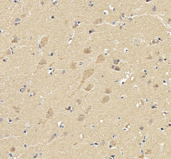 IHC staining of FFPE human brain tissue with SKP1 antibody. HIER: boil tissue sections in pH8 EDTA buffer for 20 min and allow to cool before testing.