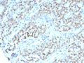 IHC staining of FFPE human fallopian tube tissue with BTBD9 antibody (clone BTBD9/7501). HIER: boil tissue sections in pH 9 10mM Tris with 1mM EDTA for 20 min and allow to cool before testing.