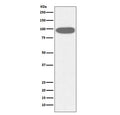 Western blot testing of human HeLa cell lysate with HSP90B1 antibody. Predicted molecular weight ~94 kDa.