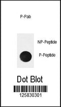Dot blot analysis of phospho-IkBa antibody. 50ng of phos-peptide or nonphos-peptide per dot were spotted.