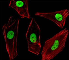 Fluorescent image of SH-SY5Y cells stained with SUMO2/3 antibody diluted at 1:100 dilution. An Alexa Fluor 488-conjugated goat anti-rabbit lgG was used as the secondary Ab (green). Cytoplasmic actin was counterstained with Alexa Fluor 555 conjugated with Phalloidin (red).