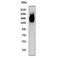Western blot testing of human A431 cell lysate with EGFR antibody at 0.5ug/ml. Expected molecular weight: ~134 kDa (unmodified), ~170 kDa (glycosylated).
