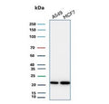 Western blot testing of human A549 and MCF7 cell lysate with recombinant BAX antibody (clone BAX/3158R). Predicted molecular weight ~21 kDa.