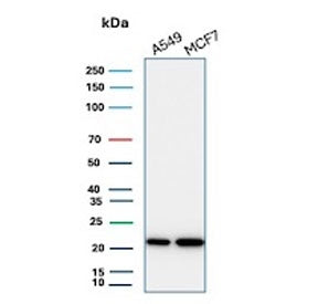 Western blot testing of human A549 and MCF7 cell lysate with recombinant BAX antibody (clone BAX/3158R). Predicted molecular weight ~21 kDa.