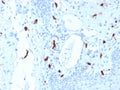 IHC testing of FFPE human tonsil tissue with TPSAB1 antibody (clone TPSAB1/1961). HIER: boil tissue sections in pH6, 10mM citrate buffer, for 10-20 min followed by cooling at RT for 20 min.