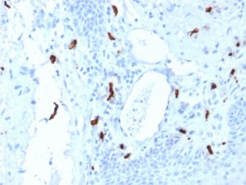 IHC testing of FFPE human tonsil tissue with TPSAB1 antibody (clone TPSAB1/1961). HIER: boil tissue sections in pH6, 10mM citrate buffer, for 10-20 min followed by cooling at RT for 20 min.