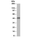 Western blot testing of human heart lysate with ACTR1B antibody at 1ug/ml. Predicted/observed molecular weight: ~45kDa.