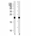 NRAS antibody western blot analysis in 1) human A431 and 2) rat C6 lysate. Predicted molecular weight ~21 kDa.