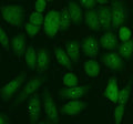Immunofluorescent staining of FFPE human SiHa cells with PER1 antibody (green). HIER: steam section in pH6 citrate buffer for 20 min.