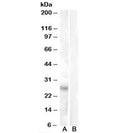 Western blot testing of heart lysate with RASSF3 antibody at 0.5ug/ml with [B] and without [A] immunizing/blocking peptide. Predicted molecular weight: ~27kDa.