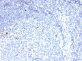 IHC staining of FFPE human tonsil tissue with CTLA4 antibody (clone rCTLA4/7219). Inset: PBS used in place of primary Ab (secondary Ab negative control). HIER: boil tissue sections in pH 9 10mM Tris with 1mM EDTA for 20 min and allow to cool before testing.