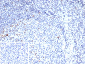 IHC staining of FFPE human tonsil tissue with CTLA4 antibody (clone rCTLA4/7219). Inset: PBS used in place of primary Ab (secondary Ab negative control). HIER: boil tissue sections in pH 9 10mM Tris with 1mM EDTA for 20 min and allow to cool before testing.