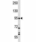 FAP antibody western blot analysis in NCI-H292 lysate. Predicted molecular weight 88~95 kDa (monomer) and 170 kDa (dimer)