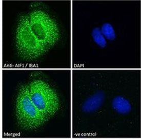 Immunofluorescent staining of FFPE human Caco-2 cells with IBA1 antibody (green) at 10ug/ml and DAPI nuclear stain (blue).