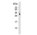 Western blot testing of human lung tissue lysate with ELOVL6 antibody. Predicted molecular weight ~31 kDa.