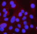 IF analysis of Syncoilin/SYNC using anti-SYNC antibody (red). SYNC was detected in an immunocytochemical section of U2OS cells. Enzyme antigen retrieval was performed using IHC enzyme antigen retrieval reagent for 15 mins. The cells were blocked with 10% goat serum. And then incubated with 5 ug/ml rabbit anti-SYNC antibody overnight at 4oC. Cy3 Conjugated Goat Anti-Rabbit IgG was used as secondary antibody at 1:500 dilution and incubated for 30 min at 37oC. The section was counterstained with DAPI (blue).