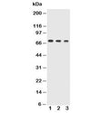 Western blot testing of Trem1 antibody and Lane 1: recombinant mouse protein 10ng; 2: 5ng; 3: 2.5ng. The chimeric recombinant protein used for this test contains AA 21-202 + human Fc and is glycosylated.