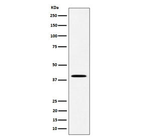 Western blot testing of human JAR cell lysate with DLX3 antibody. Predicted molecular weight ~32 kDa, commonly observed at 32-38 kDa.
