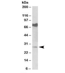 Western blot testing of mouse heart lysate with Nmnat3 antibody at 0.5ug/ml. Predicted/observed molecular weight: ~28kDa. Both observed bands are blocked by addition of immunizing peptide.