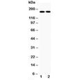 Western blot testing of Topoisomerase II alpha antibody and human 1: HeLa; 2: Jurkat cell lysate; Predicted molecular weight ~174 kDa.