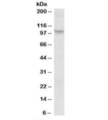 Western blot testing of mouse spleen lysate with Nlrp12 antibody at 1ug/ml. Predicted molecular weight: ~119kDa, routinely observed at 100~119kDa.