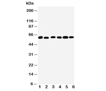 Western blot testing of Monoamine Oxidase B antibody and Lane 1: mouse liver; 2: (m) lung; 3: rat kidney; 4: (r) brain; 5: (r) liver; 6: (r) lung tissue lysate