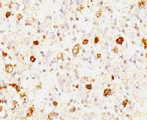 IHC: Formalin-fixed, paraffin-embedded human pituitary stained with FSH-beta antibody (clone FSHb/1062).