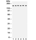 Western blot testing of 1) rat brain, 2) rat liver, 3) human HeLa, 4) CEM, 5) A549 and 6) MCF7 lysate with ROCK2 antibody. Expected/observed molecular weight: ~161 kDa.