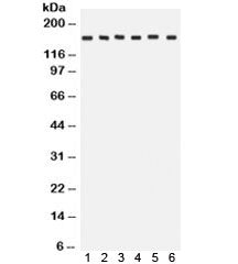 Western blot testing of 1) rat brain, 2) rat liver, 3) human HeLa, 4) CEM, 5) A549 and 6) MCF7 lysate with ROCK2 antibody. Expected/observed molecular weight: ~161 kDa.