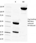 SDS-PAGE Analysis of Purified, BSA-Free CD14 Antibody (clone LPSR/927). Confirmation of Integrity and Purity of the Antibody.