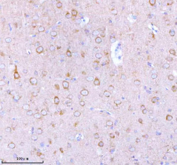 Immunohistochemical staining of STXBP6 using anti-STXBP6 antibody. STXBP6 was detected in a paraffin-embedded section of mouse brain tissue. Heat mediated antigen retrieval was performed in EDTA buffer (pH 8.0, epitope retrieval solution). The tissue section was blocked with 10% goat serum. The tissue section was then incubated with 2 ug/ml rabbit anti-STXBP6 antibody overnight at 4oC. Peroxidase Conjugated Goat Anti-rabbit IgG was used as secondary antibody and incubated for 30 min at 37oC.