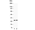 Western blot testing of Claudin 2 antibody and Lane 1: rat kidney; 2: rat liver
