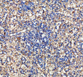 IHC staining of FFPE human spleen tissue with human IL-10 antibody, HRP-labeled secondary and DAB substrate. HIER: boil tissue sections in pH8 EDTA for 20 min and allow to cool before testing.