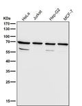 Western blot testing of human samples using the RPN1 antibody at 1:3000 dilution for 1 hour at room temperature. A predominant band is detected at an approximately 68 kDa in all samples, consistent with the mature N-glycosylated ER membrane protein ribophorin I described in the literature. Additional weaker bands between roughly 50 and 60 kDa, likely represent truncated or processed RPN1 species generated during normal ER associated degradation rather than distinct full length isoforms.