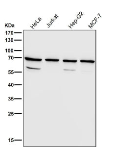 Western blot testing of human samples using the RPN1 antibody at 1:3000 dilution for 1 hour at room temperature. A predominant band is detected at an approximately 68 kDa in all samples, consistent with the mature N-glycosylated ER membrane protein ribophorin I described in the literature. Additional weaker bands between roughly 50 and 60 kDa, likely represent truncated or processed RPN1 species generated during normal ER associated degradation rather than distinct full length isoforms.
