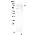 Western blot testing of rat 1) testis and 2) PC-12 lysate with RTEL1 antibody at 0.5ug/ml. Predicted molecular weight ~134 kDa.
