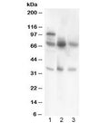 Western blot testing of GAD67 antibody and Lane 1: rat testis; 2: mouse brain; 3: human MCF7 lysate. Predicted/observed molecular weight ~67 kDa