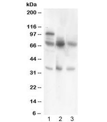 Western blot testing of GAD67 antibody and Lane 1: rat testis; 2: mouse brain; 3: human MCF7 lysate. Predicted/observed molecular weight ~67 kDa