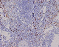 IHC staining of FFPE human spleen tissue with CD8 alpha antibody. HIER: boil tissue sections in pH6, 10mM citrate buffer, for 10-20 min and allow to cool before testing.