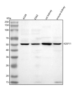 Western blot analysis of IGSF11 using anti-IGSF11 antibody. Lane 1: human whole cell lysates, Lane 2: human K562 whole cell lysates, Lane 3: rat kidney tissue lysates, Lane 4: mouse kidney tissue lysates. After electrophoresis, proteins were transferred to a nitrocellulose membrane at 150 mA for 50-90 min. Blocked the membrane with 5% non-fat milk/TBS for 1.5 hour at RT.