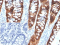 IHC staining of FFPE human colon tissue with PDGFB antibody (clone PDGFB/3072). Negative control inset: PBS instead of primary antibody to control for secondary binding. HIER: boil tissue sections in pH 9 10mM Tris with 1mM EDTA for 20 min and allow to cool before testing.