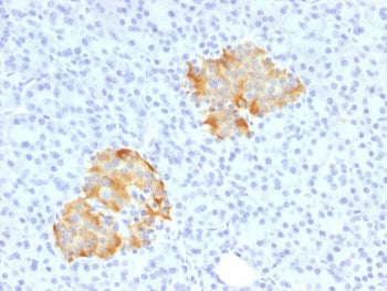 IHC staining of FFPE human pancreas with TNF alpha antibody. HIER: boil tissue sections in pH 9 10mM Tris with 1mM EDTA for 20 min and allow to cool before testing.