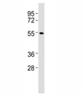 Western blot testing of CB1 antibody at 1:2000 dilution + A431 lysate; Predicted molecular weight ~54 kDa.
