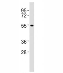 Western blot testing of CB1 antibody at 1:2000 dilution + A431 lysate; Predicted molecular weight ~54 kDa.