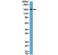 Western blot testing of human placental tissue lysate with recombinant CD163 antibody at 1:2000 dilution. Predicted molecular weight ~130 kDa but may be observed at higher molecular weights due to glycosylation.