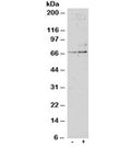 Western blot testing of untreated (left) and TGFBI-treated (right, 1ng/ml, 24hr) primary cultured human lung fibroblasts with SRF antibody at 1ug/ml. Predicted molecular weight: ~52/60-70kDa (unmodified/phosphorylated).