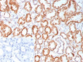 IHC staining of FFPE human kidney tissue with Fibroblast Growth Factor 23 antibody (clone FGF23/9060). Inset: PBS used in place of primary Ab (secondary Ab negative control). HIER: boil tissue sections in pH 9 10mM Tris with 1mM EDTA for 20 min and allow to cool before testing.