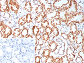 IHC staining of FFPE human kidney tissue with Fibroblast Growth Factor 23 antibody (clone FGF23/9060). Inset: PBS used in place of primary Ab (secondary Ab negative control). HIER: boil tissue sections in pH 9 10mM Tris with 1mM EDTA for 20 min and allow to cool before testing.