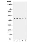 Western blot testing of 1) human placenta, 2) rat lung, 3) rat brain, 4) U87 and 5) A431 lysate with TACR1 antibody. Predicted molecular weight ~46 kDa but routinely observed at ~58 kDa.